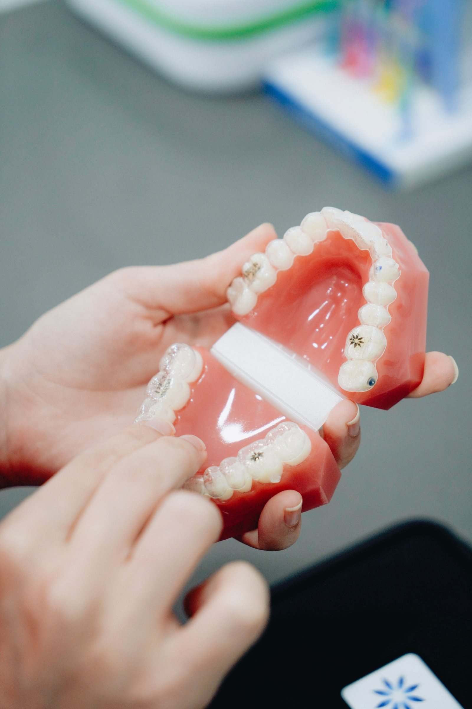 Perbandingan braces logam dengan aligner lutsinar